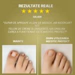 parere-iulian-despre-micotic-protect