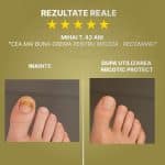 parere-mihai-t.-despre-micotic-protect