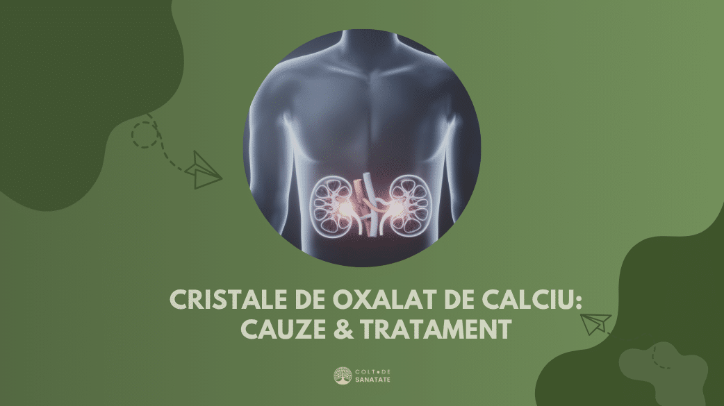 Cristale de Oxalat de Calciu: Definitie, Cauze, Tratament